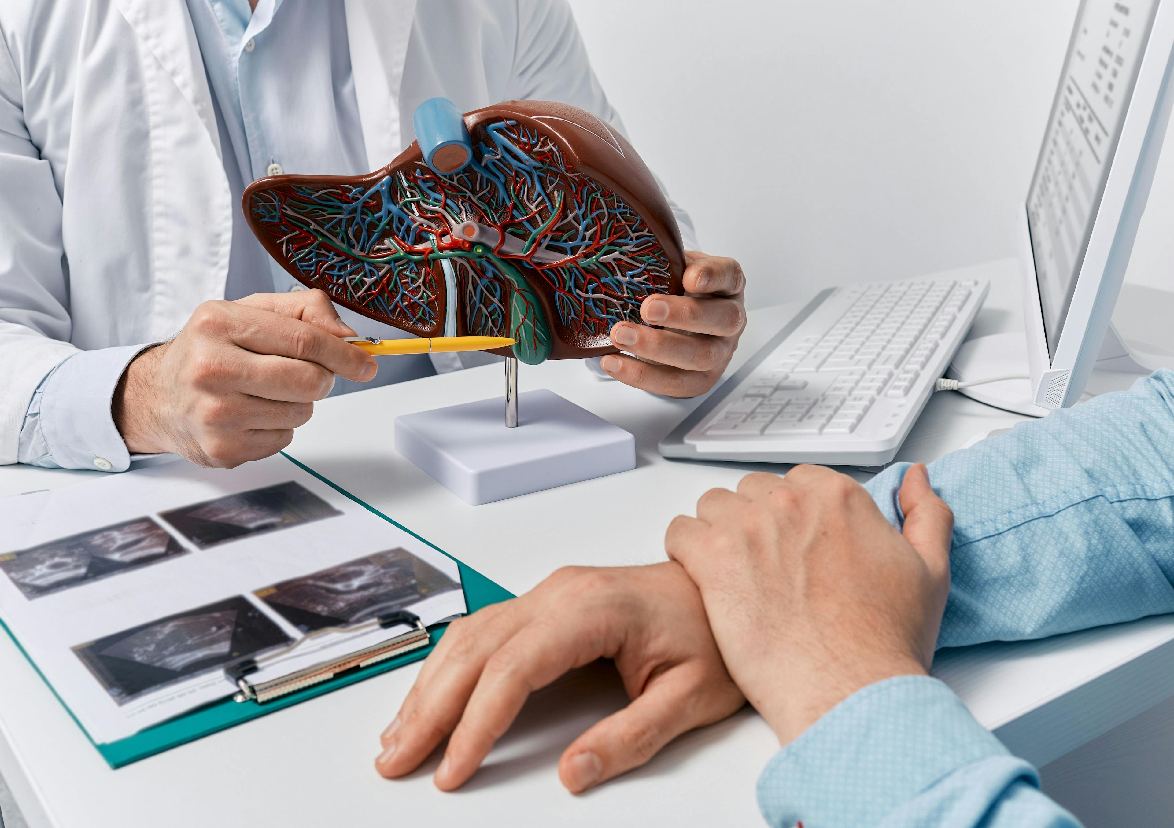 Human liver model on doctor's table, close-up. Treatment of hepatitis, cirrhosis and liver cancer | Image Credit: © Peakstock - stock.adobe.com
