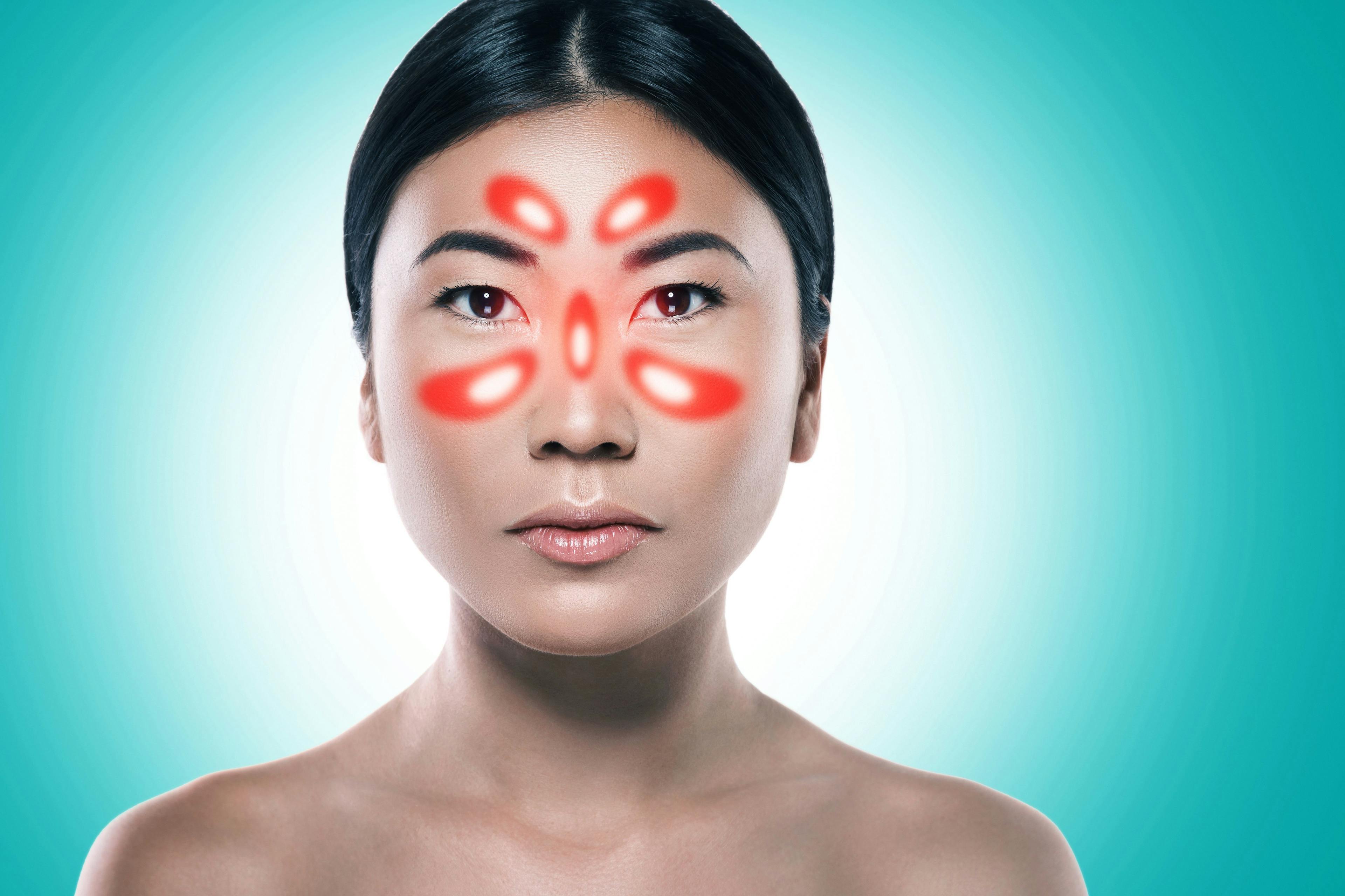 Asian woman with symptoms of sinusitis and inflammation of the mucous membrane | Image Credit: © blackday - stock.adobe.com