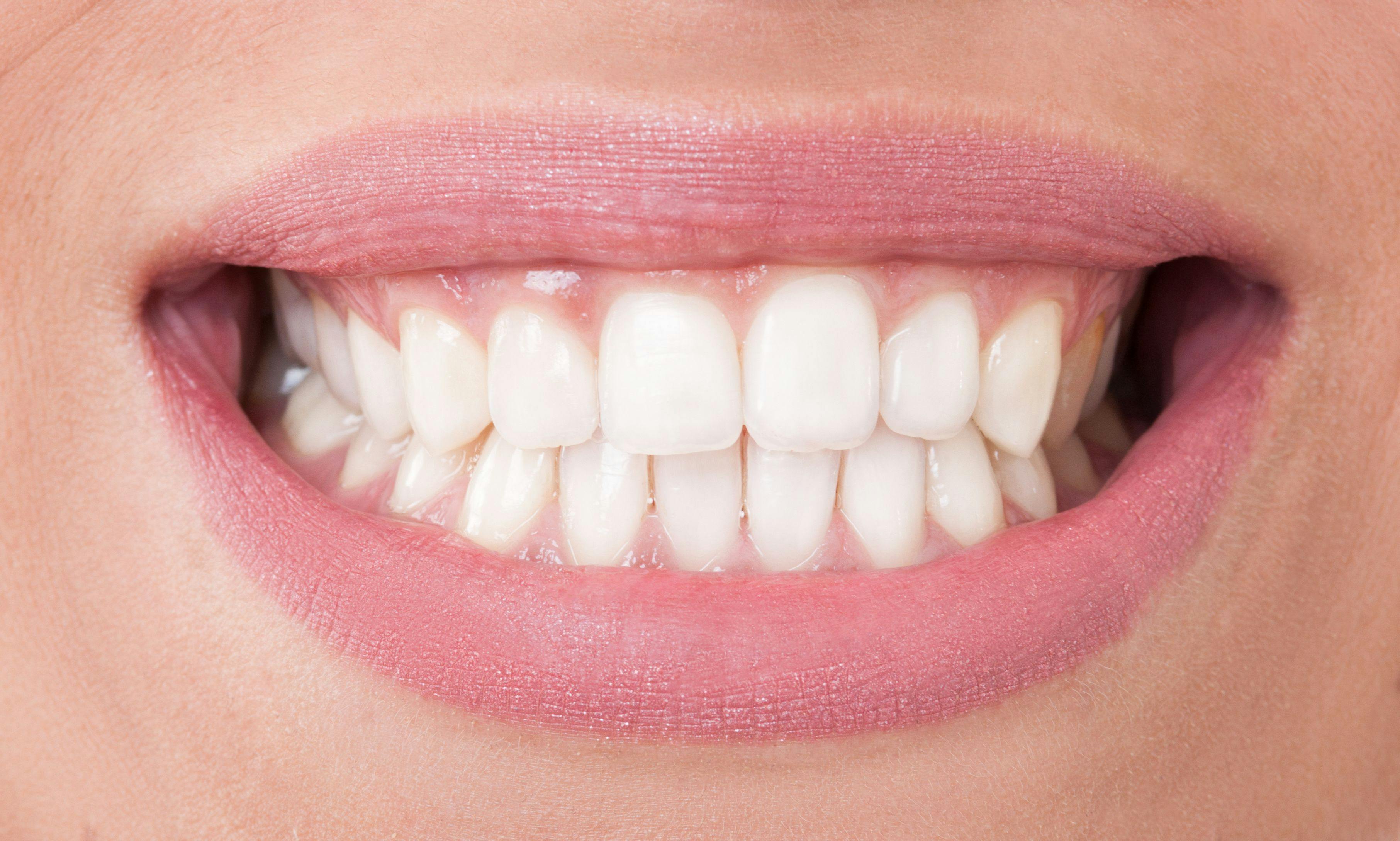 Closeup with perfect female teeth. © Catalin Pop- stock.adobe.com