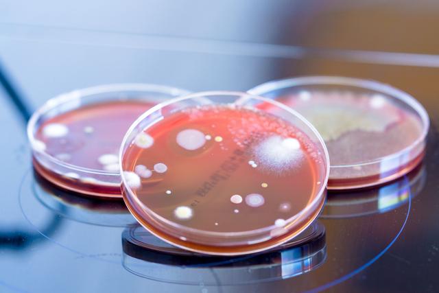 petri dishes with colonies of microorganisms in a biological laboratory | Image Credit: © luchschenF - stock.adobe.com